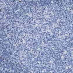 Invitrogen ASS1 Polyclonal Antibody 100 &mu;L; Unconjugated:Antibodies,
