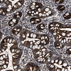 Invitrogen PASK Polyclonal Antibody 100 &mu;L; Unconjugated:Antibodies,