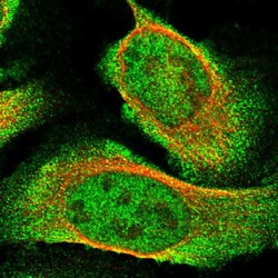 Invitrogen USP16 Polyclonal Antibody 100 &mu;L; Unconjugated:Antibodies,