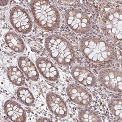 Invitrogen NYREN18 Polyclonal Antibody 100 &mu;L; Unconjugated:Antibodies,