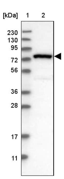 Invitrogen NYREN18 Polyclonal Antibody 100 &mu;L; Unconjugated:Antibodies,