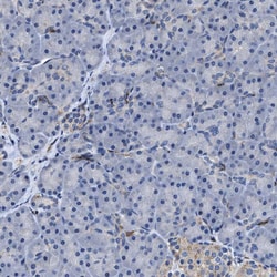 Invitrogen RGS10 Polyclonal Antibody 100 &mu;L | Buy Online | Invitrogen&trade; | Fisher Scientific
