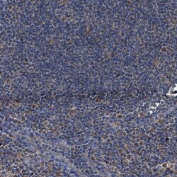 Invitrogen HSD17B4 Polyclonal Antibody 100 &mu;L; Unconjugated:Antibodies,