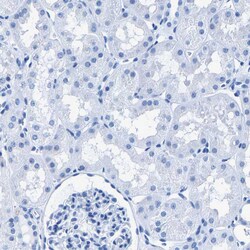 Invitrogen CPS1 Polyclonal Antibody 100 &mu;L; Unconjugated:Antibodies,