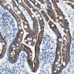 Invitrogen CPS1 Polyclonal Antibody 100 &mu;L; Unconjugated:Antibodies,