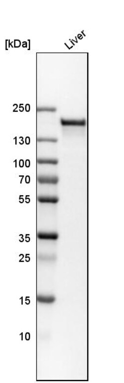 Invitrogen CPS1 Polyclonal Antibody 100 &mu;L; Unconjugated:Antibodies,