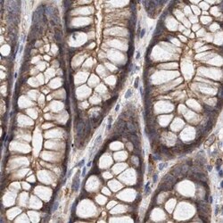 Invitrogen NSP5 Polyclonal Antibody 100 &mu;L; Unconjugated:Antibodies,