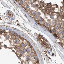 Invitrogen NSP5 Polyclonal Antibody 100 &mu;L; Unconjugated:Antibodies,