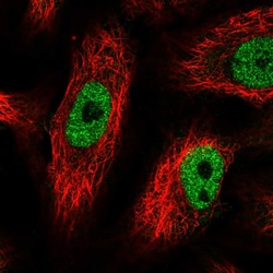 Invitrogen PHF12 Polyclonal Antibody 100 &mu;L; Unconjugated:Antibodies,
