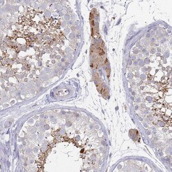 Invitrogen NPEPPS Polyclonal Antibody 100 &mu;L | Buy Online | Invitrogen&trade; | Fisher Scientific