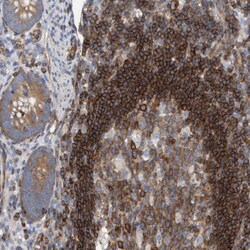 Invitrogen PRKD2 Polyclonal Antibody 100 &mu;L; Unconjugated:Antibodies,