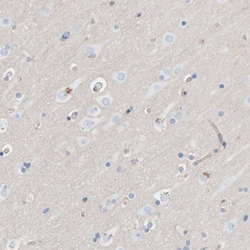 Invitrogen PRKD2 Polyclonal Antibody 100 &mu;L; Unconjugated:Antibodies,