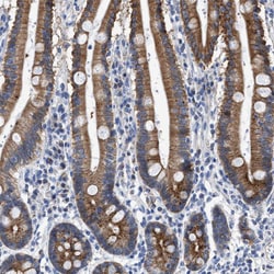 Invitrogen Jagged1 Polyclonal Antibody 100 &mu;L; Unconjugated:Antibodies,