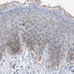Invitrogen Jagged1 Polyclonal Antibody 100 &mu;L; Unconjugated:Antibodies,