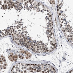 Invitrogen POLR2A Polyclonal Antibody 100 &mu;L; Unconjugated:Antibodies,