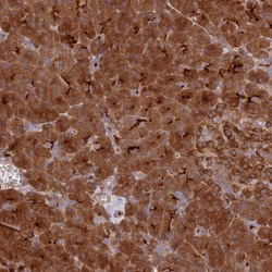 Invitrogen ECM29 Polyclonal Antibody 100 &mu;L | Buy Online | Invitrogen&trade; | Fisher Scientific