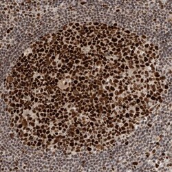 Invitrogen CAF1 p60 Polyclonal Antibody 100 &mu;L; Unconjugated:Antibodies,