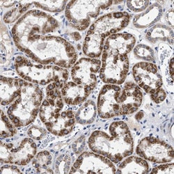 Invitrogen CHRDL2 Polyclonal Antibody 100 μL; Unconjugated:Antibodies,