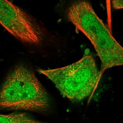 Invitrogen MBTD1 Polyclonal Antibody 100 &mu;L; Unconjugated:Antibodies,