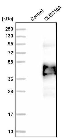 Invitrogen CD301 Polyclonal Antibody 100 &mu;L; Unconjugated:Anticorps,