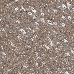 Invitrogen Torc1 Polyclonal Antibody 100 &mu;L | Buy Online | Invitrogen&trade; | Fisher Scientific