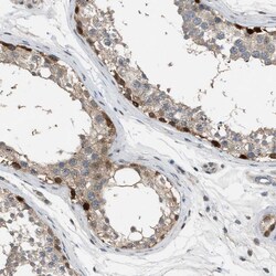 Invitrogen Torc1 Polyclonal Antibody 100 &mu;L | Buy Online | Invitrogen&trade; | Fisher Scientific