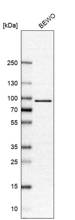 Invitrogen Torc1 Polyclonal Antibody 100 &mu;L | Buy Online | Invitrogen&trade; | Fisher Scientific