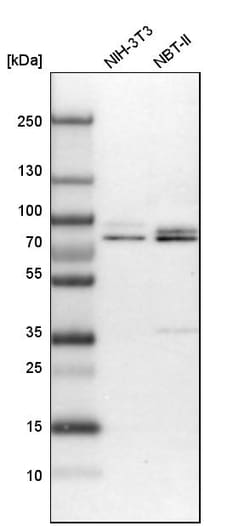 Invitrogen Torc1 Polyclonal Antibody 100 &mu;L | Buy Online | Invitrogen&trade; | Fisher Scientific