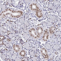 Invitrogen RUNX2 Polyclonal Antibody 100 &mu;L; Unconjugated:Antibodies,