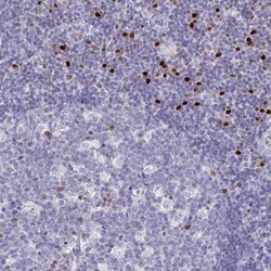 Invitrogen RUNX2 Polyclonal Antibody 100 &mu;L; Unconjugated:Antibodies,