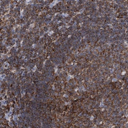 Invitrogen FNBP1 Polyclonal Antibody 100 &mu;L; Unconjugated:Antibodies,
