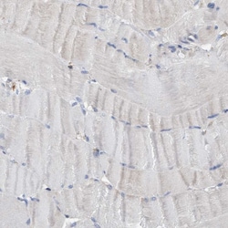 Invitrogen FNBP1 Polyclonal Antibody 100 &mu;L; Unconjugated:Antibodies,