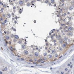 Invitrogen FNBP1 Polyclonal Antibody 100 &mu;L; Unconjugated:Antibodies,