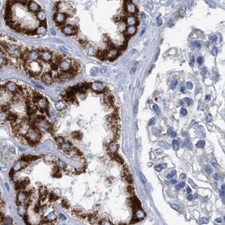 Invitrogen PECI Polyclonal Antibody 100 &mu;L; Unconjugated:Antibodies,