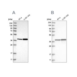 Invitrogen PECI Polyclonal Antibody 100 &mu;L; Unconjugated:Antibodies,