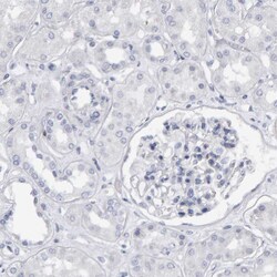 Invitrogen CD38 Polyclonal Antibody 100 &mu;L | Buy Online | Invitrogen&trade; | Fisher Scientific