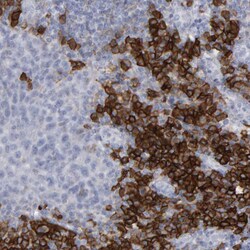 Invitrogen CD38 Polyclonal Antibody 100 &mu;L | Buy Online | Invitrogen&trade; | Fisher Scientific