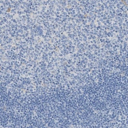 Invitrogen Aspartoacylase Polyclonal Antibody 100 &mu;L | Buy Online | Invitrogen&trade; | Fisher Scientific