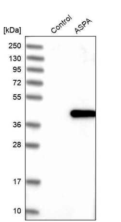 Invitrogen Aspartoacylase Polyclonal Antibody 100 &mu;L | Buy Online | Invitrogen&trade; | Fisher Scientific