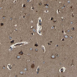 Invitrogen LPCAT1 Polyclonal Antibody 100 &mu;L; Unconjugated:Antibodies,