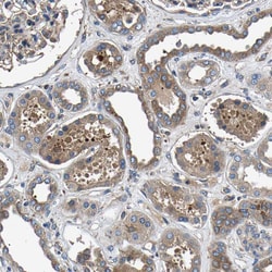 Invitrogen LPCAT1 Polyclonal Antibody 100 &mu;L; Unconjugated:Antibodies,