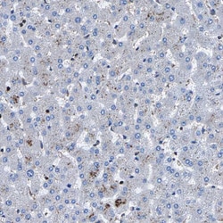 Invitrogen LPCAT1 Polyclonal Antibody 100 &mu;L; Unconjugated:Antibodies,