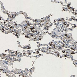 Invitrogen LPCAT1 Polyclonal Antibody 100 &mu;L; Unconjugated:Antibodies,
