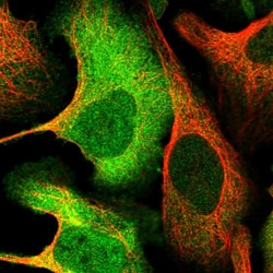 Invitrogen ATP Citrate Lyase Polyclonal Antibody 100 &mu;L; Unconjugated:Antibodies,