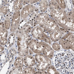 Invitrogen ATP Citrate Lyase Polyclonal Antibody 100 &mu;L; Unconjugated:Antibodies,