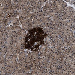 Invitrogen ATP Citrate Lyase Polyclonal Antibody 100 &mu;L; Unconjugated:Antibodies,