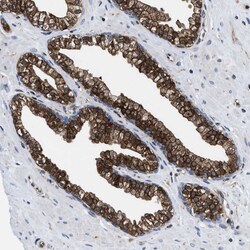 Invitrogen ATP Citrate Lyase Polyclonal Antibody 100 &mu;L; Unconjugated:Antibodies,