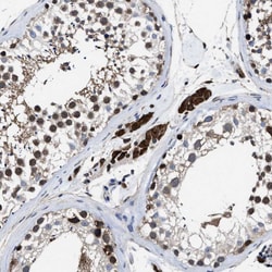 Invitrogen ATP Citrate Lyase Polyclonal Antibody 100 &mu;L; Unconjugated:Antibodies,
