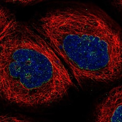 Invitrogen CAT1 Polyclonal Antibody 100 &mu;L; Unconjugated:Antibodies,