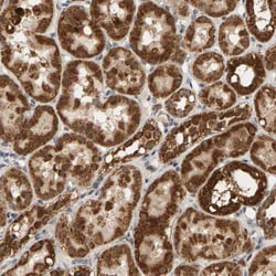 Invitrogen GSTK1 Polyclonal Antibody 100 &mu;L; Unconjugated:Antibodies,